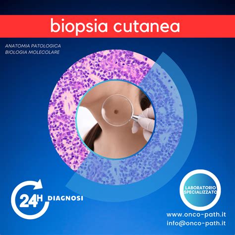 Diagramma delle diverse tecniche di biopsia cutanea