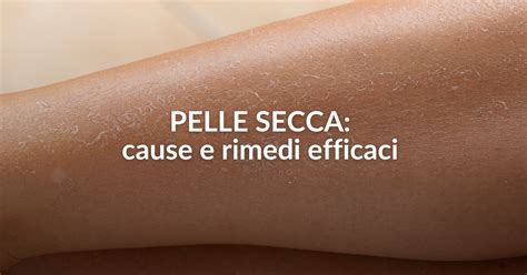mani con pelle secca prima e dopo applicazione crema