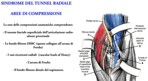 Diagramma anatomico che mostra la posizione del lembo interosseo posteriore (PIAF) nell'avambraccio.