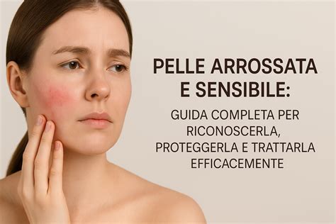 Pelle arrossata e sensibile