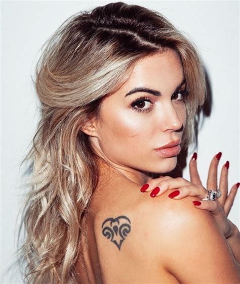 Ludovica Pagani con cicatrice visibile