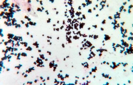 Micrografia di Staphylococcus hyicus