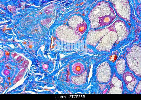 Microscopio che mostra i follicoli piliferi