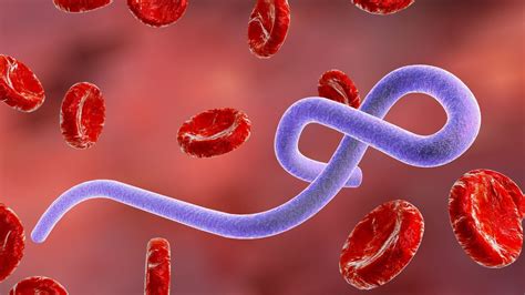 Manifestazione cutanea del virus Ebola