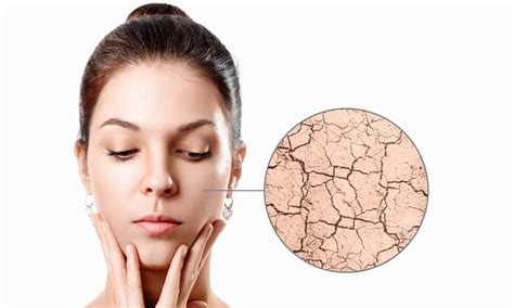 Illustrazione di una pelle sana e idratata rispetto a una pelle secca e screpolata