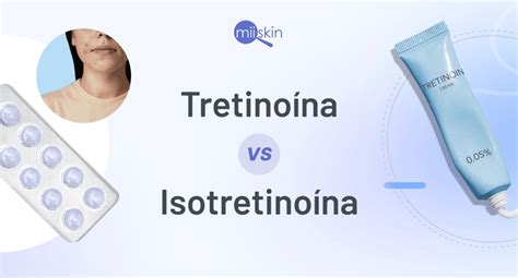 Isotretinoina pillole