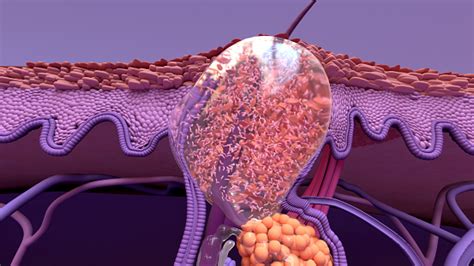 Microscopio che mostra la struttura di un poro ostruito