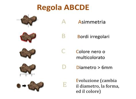 Diagramma della regola ABCDE con enfasi sull'evoluzione