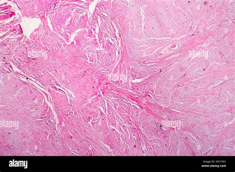 Tessuto cicatriziale visto al microscopio