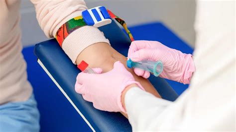 Illustrazione che mostra come applicare pressione dopo un prelievo di sangue