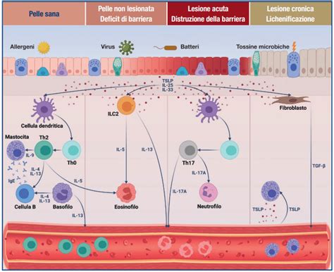 Schema che illustra la barriera cutanea compromessa nella dermatite atopica