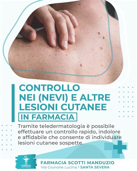 Mappa dei nei con dermatoscopio