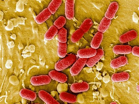 Batteri Cutibacterium acnes visti al microscopio