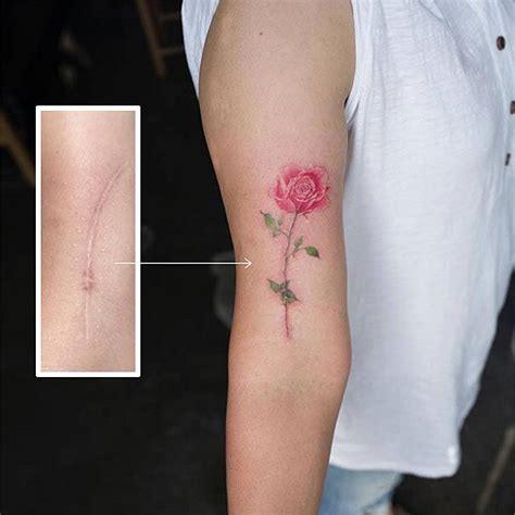 Donna con tatuaggio che copre una cicatrice sul braccio