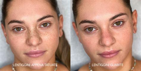 Esempio di tatuaggio che integra delle lentiggini