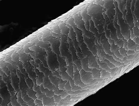 Microscopio che mostra depositi di sebo sulla radice di un capello