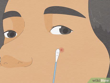 Illustrazione che mostra come non schiacciare un brufolo e l'applicazione di un impacco tiepido.