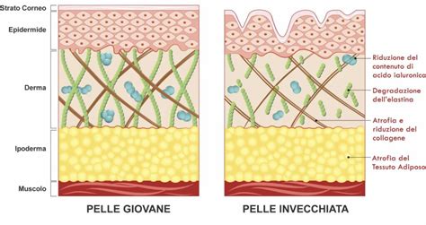 Schema del processo di photoaging sulla pelle