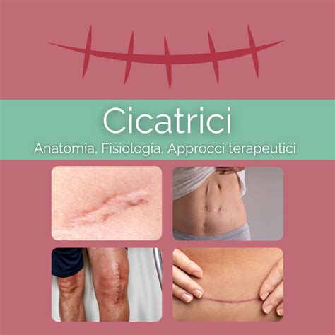 Diverse tipologie di cicatrici cutanee