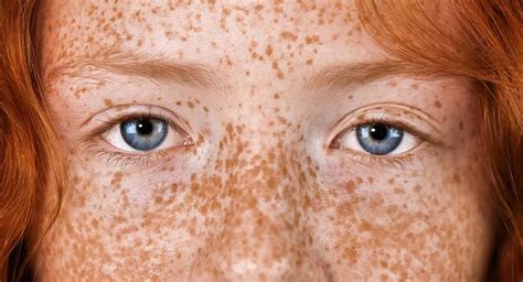 Donna con lentiggini naturali