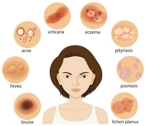 Diagramma che mostra diverse condizioni della pelle