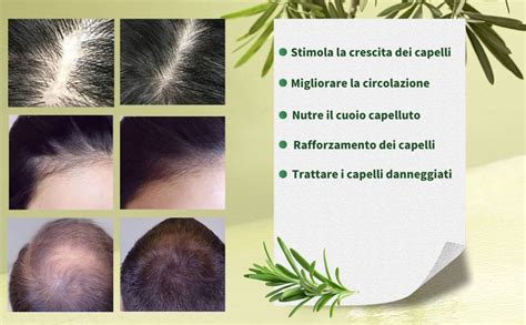 Infografica che illustra i benefici del rosmarino per i capelli