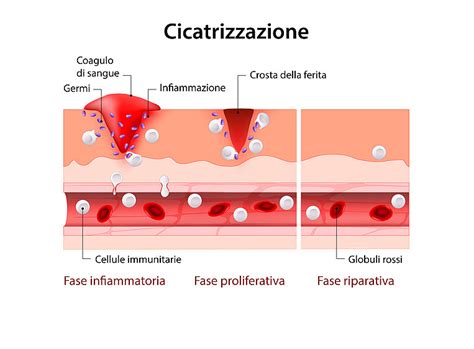Diagramma che mostra il processo di guarigione delle ferite