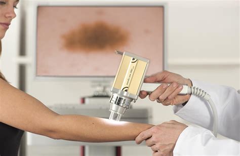 Immagine di un dermatoscopio digitale utilizzato per la mappatura dei nevi