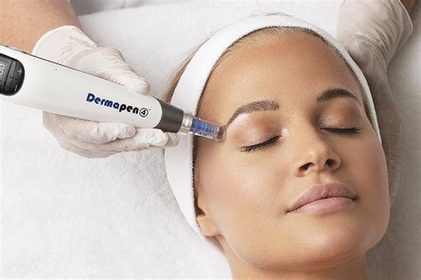 Dispositivo Dermapen utilizzato nel microneedling