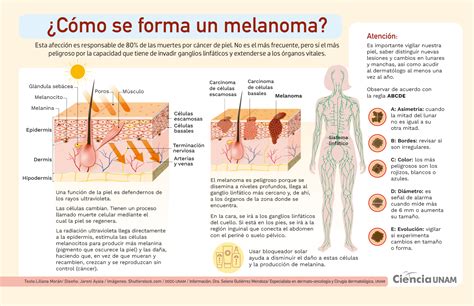 Infografica sui rischi del melanoma correlato all'abbronzatura artificiale