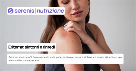 Diagramma che illustra le diverse cause di eritema