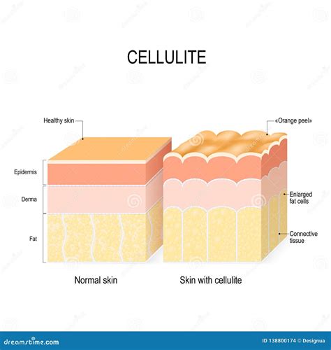 Illustrazione di una pelle sana e di una pelle con imperfezioni