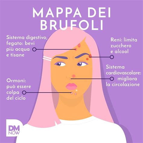 Infografica che illustra i fattori che contribuiscono alla formazione dei brufoli sottopelle