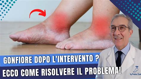 Confronto visivo tra polpacci sottili e polpacci armonizzati