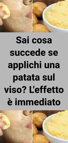 Fette di patata sul viso