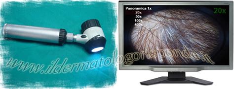 Dermatoscopia del cuoio capelluto che mostra i capelli a punto esclamativo