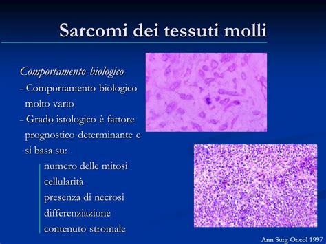 Diagramma che illustra le diverse tipologie di sarcomi dei tessuti molli
