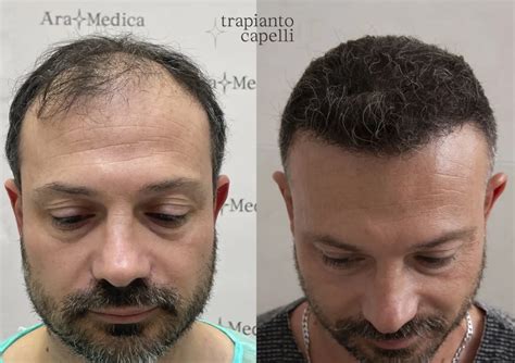 Immagine comparativa 