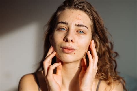 Collage di personaggi cinematografici con cicatrici sull'occhio o sul viso