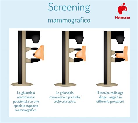 Diagramma che illustra la compressione mammaria durante la mammografia