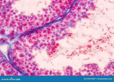 Cellule melanocitarie sotto ingrandimento
