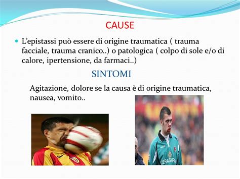 Illustrazione di un trauma facciale che può causare epistassi ed ecchimosi palpebrale