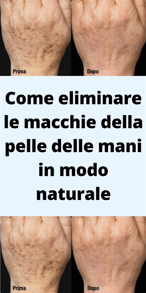 mani mature con macchie e rughe