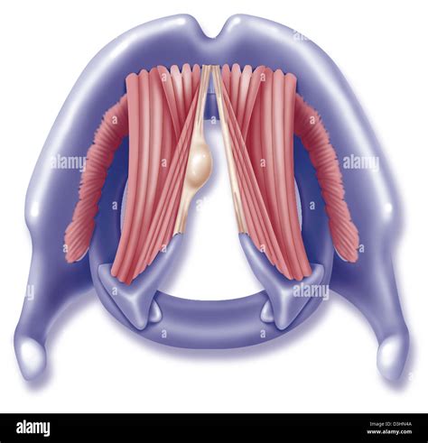 Immagine di un polipo su una corda vocale