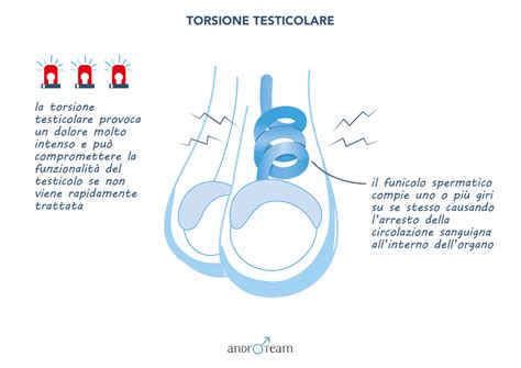 Diagramma della torsione testicolare