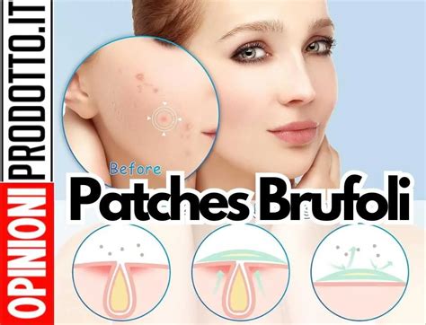Infografica passo-passo sull'applicazione corretta di un cerotto anti brufoli