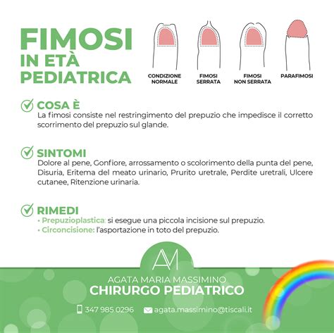 Illustrazione che mostra i passaggi corretti per lavare il pene, inclusa la retrazione del prepuzio