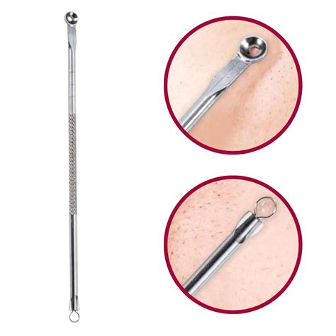 Primo piano di un estrattore di comedoni con anelli di diverse dimensioni