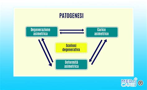 Diagramma che illustra i quattro fattori della patogenesi dell'acne