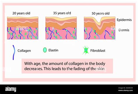 Schema anatomico della pelle con evidenziate fibre di collagene ed elastina